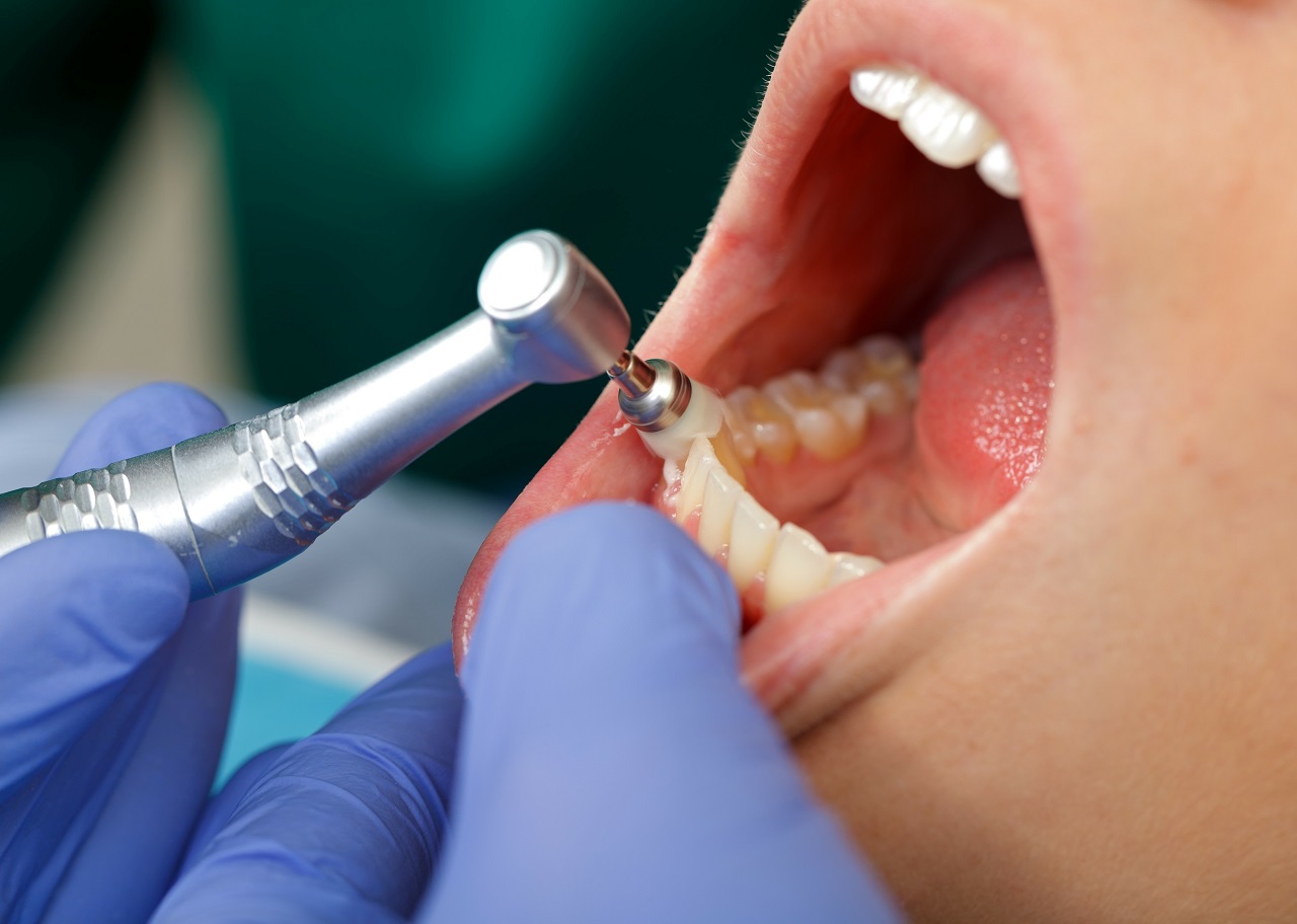 Chirurgia stomatologiczna – jakie zabiegi są przeprowadzane?